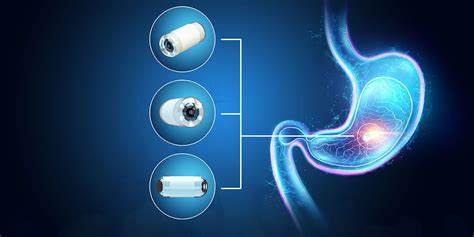 ¿Qué es la boquilla de pulverización de endoscopio?